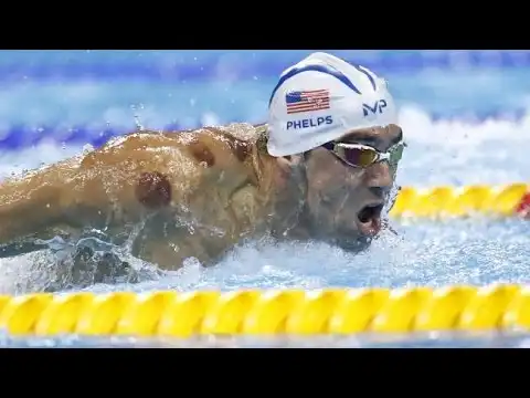 cupping at the olympics